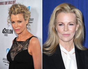 Kim-Basinger-Plastic-Surgery