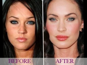 Megan Fox plastic changes