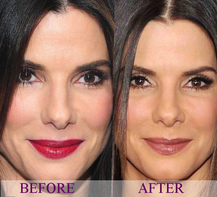 Celebrity Sandra Bullock Plastic Surgery Photos Video