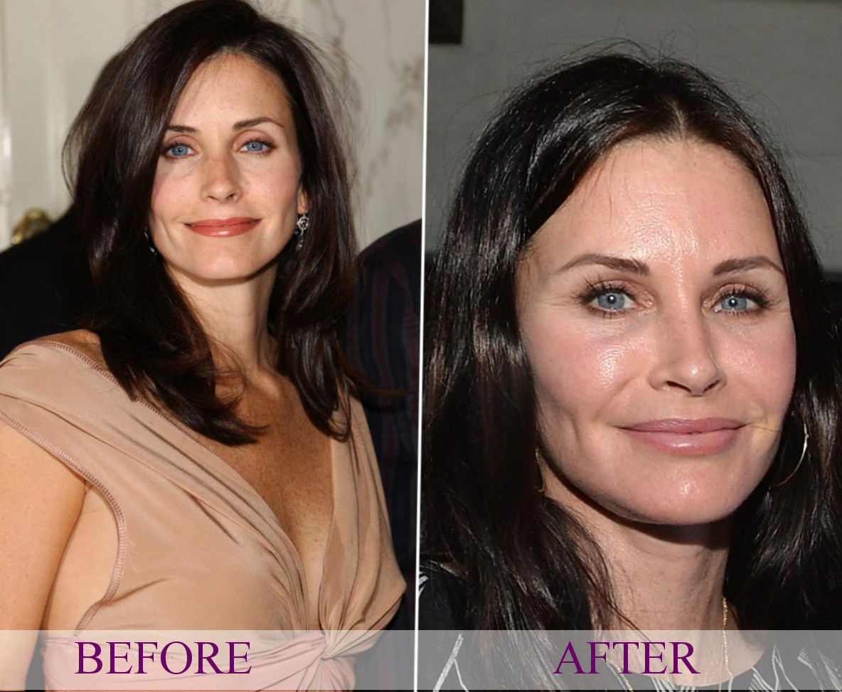 Celebrity Courteney Cox - plastic surgery, photos, video