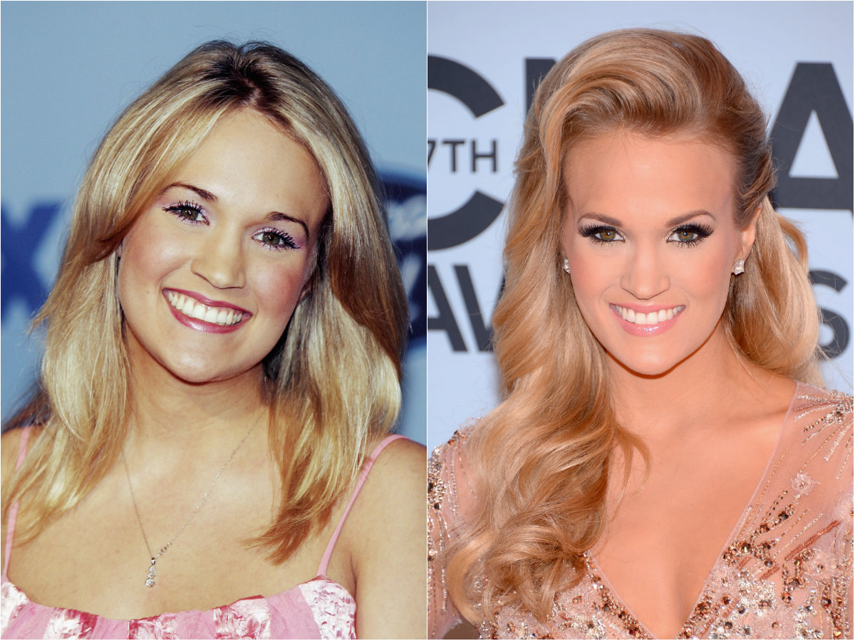 Celebrity Carrie Underwood plastic surgery, photos, video