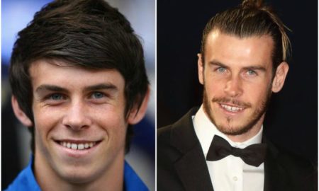 Gareth Bale`s eyes and hair color
