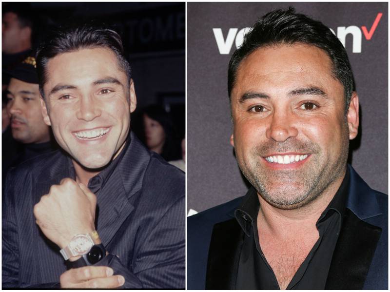 Oscar De La Hoya`s eyes and hair color