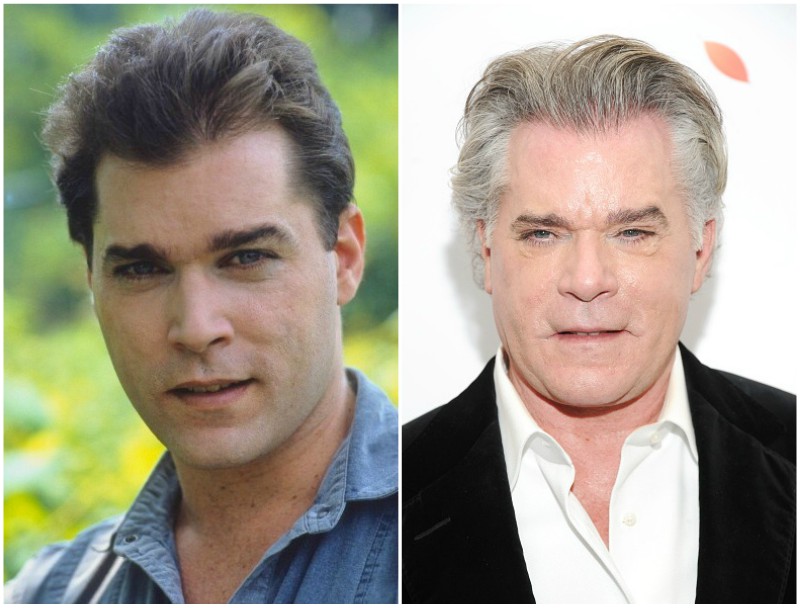 Ray Liotta Plastic Surgery