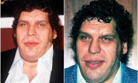 Andre The Giant's eyes and hair color
