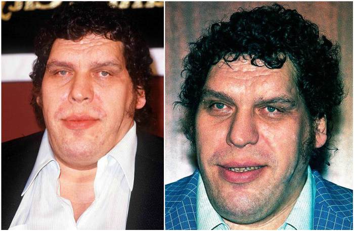 Andre The Giant's eyes and hair color