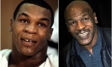 Mike Tyson’s eyes and hair color