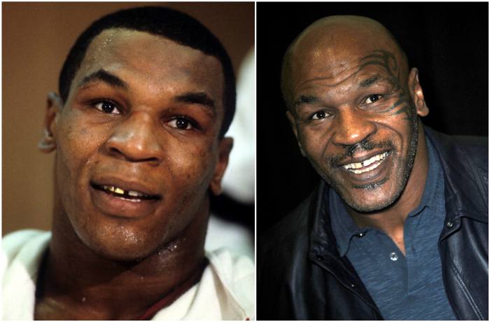 Mike Tyson’s eyes and hair color