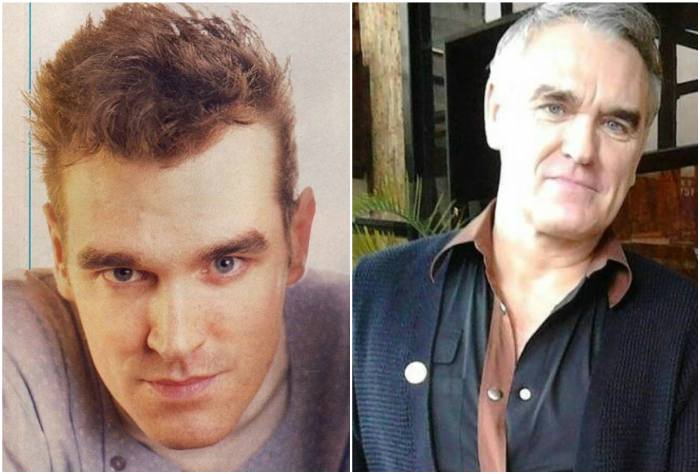 Singer Morrissey’s eyes and hair color