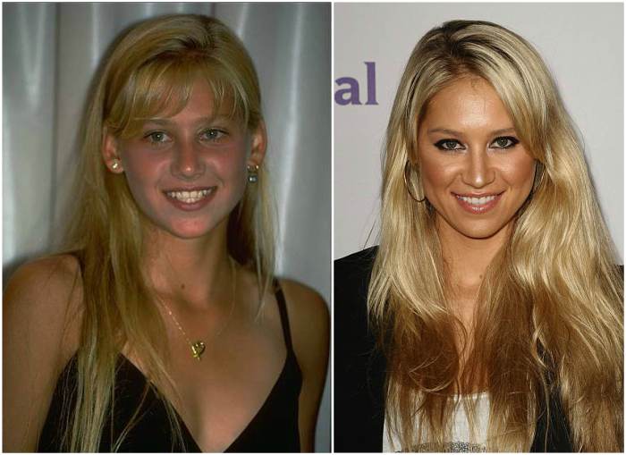 Anna Kournikova's eyes and hair color