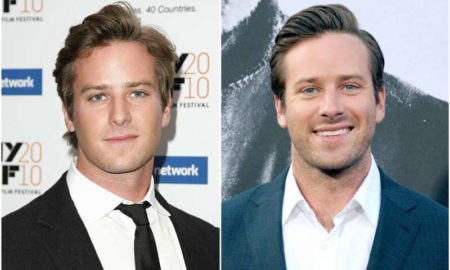 Armie Hammer's eyes and hair color