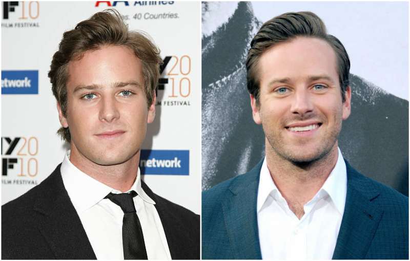 Armie Hammer's eyes and hair color