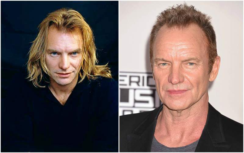 Sting’s eyes and hair color