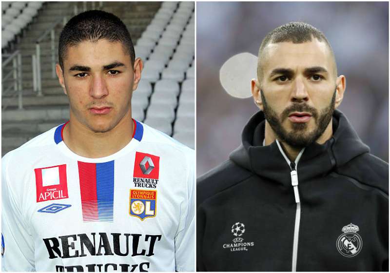 Karim Benzema's eyes and hair color