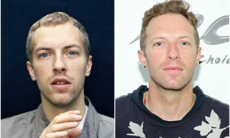 Chris Martin's eyes and hair color