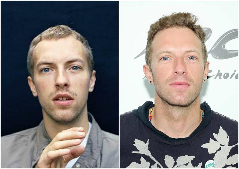 Chris Martin's eyes and hair color