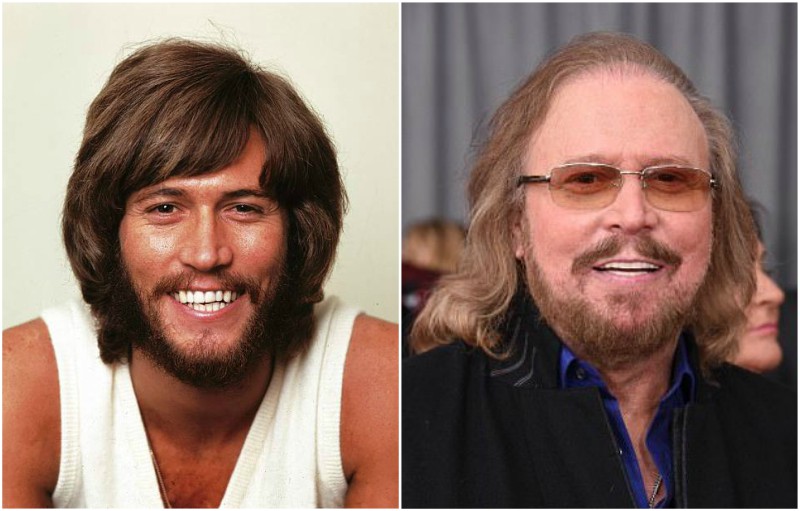 Barry Gibb's eyes and hair color