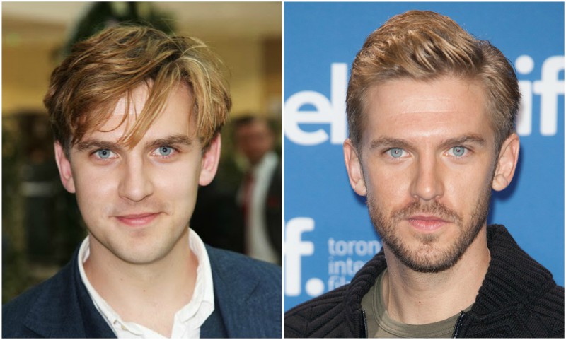 dan stevens weight loss